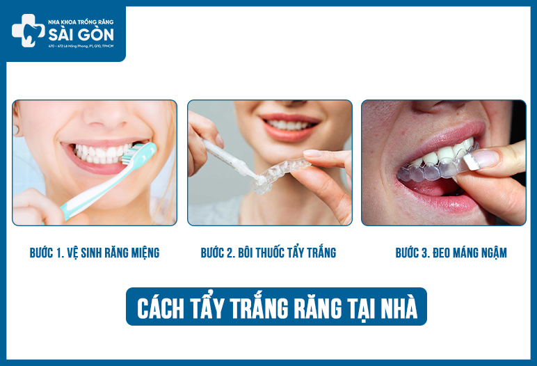 cách sử dụng thuốc tẩy trắng răng opalescence 20%