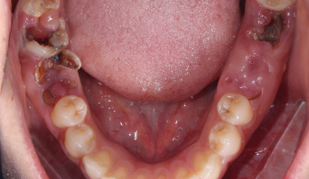 mat rang rang ben canh yeu