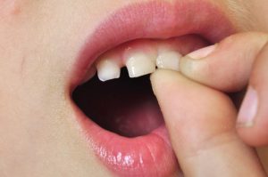 rang lung lay dau nhuc