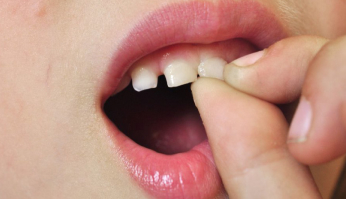 rang lung lay dau nhuc