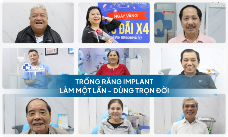 trong rang implant section cuoi