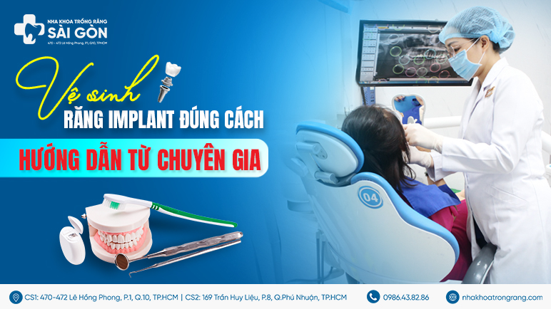 vệ sinh răng implant