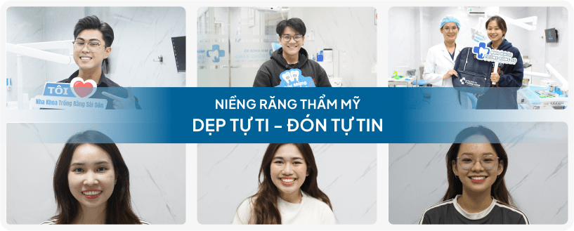 khách hàng niềng răng thẩm mỹ thành công