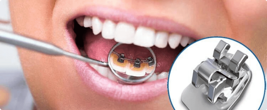 nieng rang tham my 14