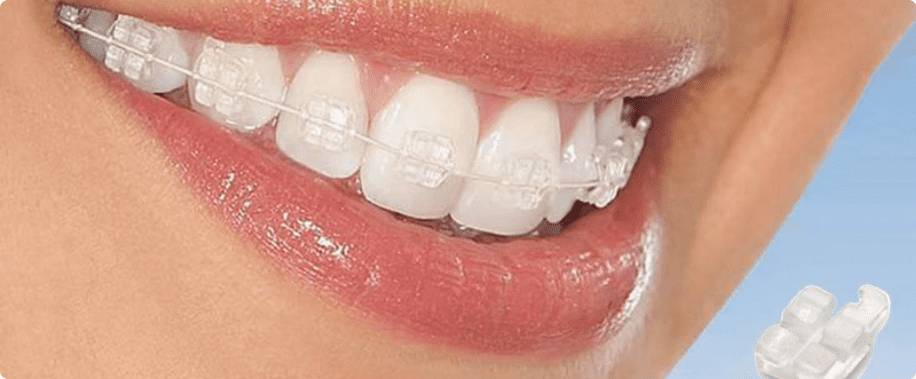 nieng rang tham my 3