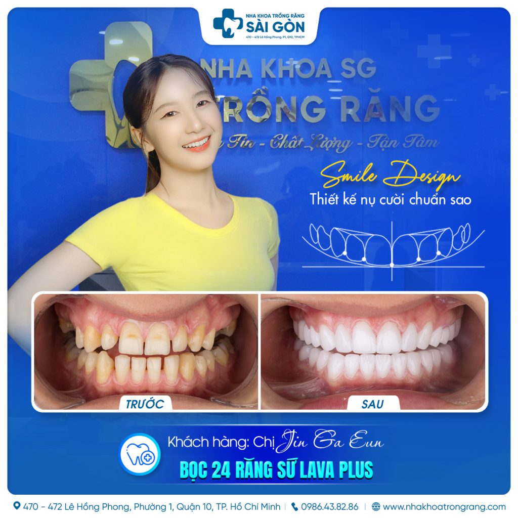 Jin Ga Eun 24 rang su Lava Plus