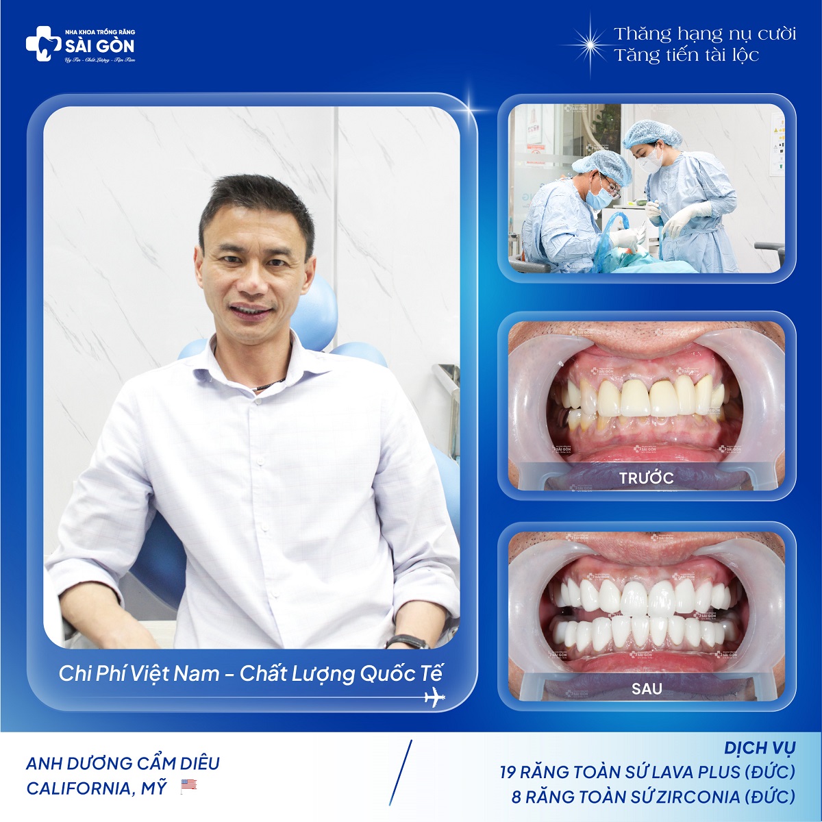 Anh Dương Cẩm Diêu Việt Kiều Mỹ Bọc 19 Răng Sứ Lava Plus và 8 Răng Sứ Zirconia của Đức