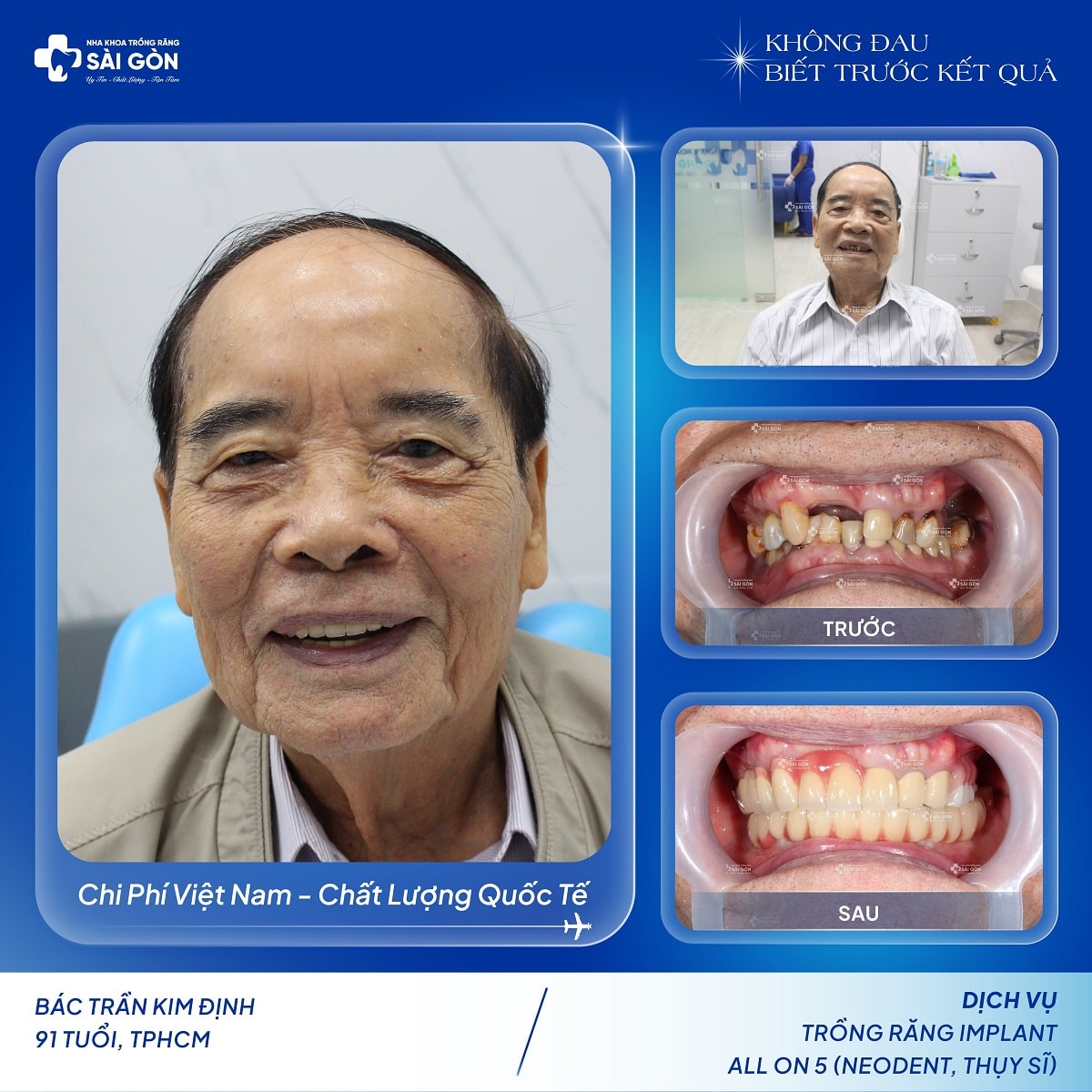 Bác Trần Kim Định trồng răng implant All On 5 ở tuổi U90