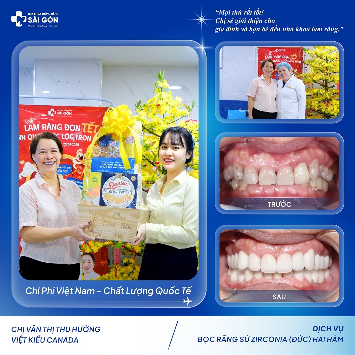 Chị Văn Thị Thu Hường (Việt Kiều Canada) bọc 28 răng sứ Zirconia (Đức) tại Nha Khoa Trồng Răng Sài Gòn