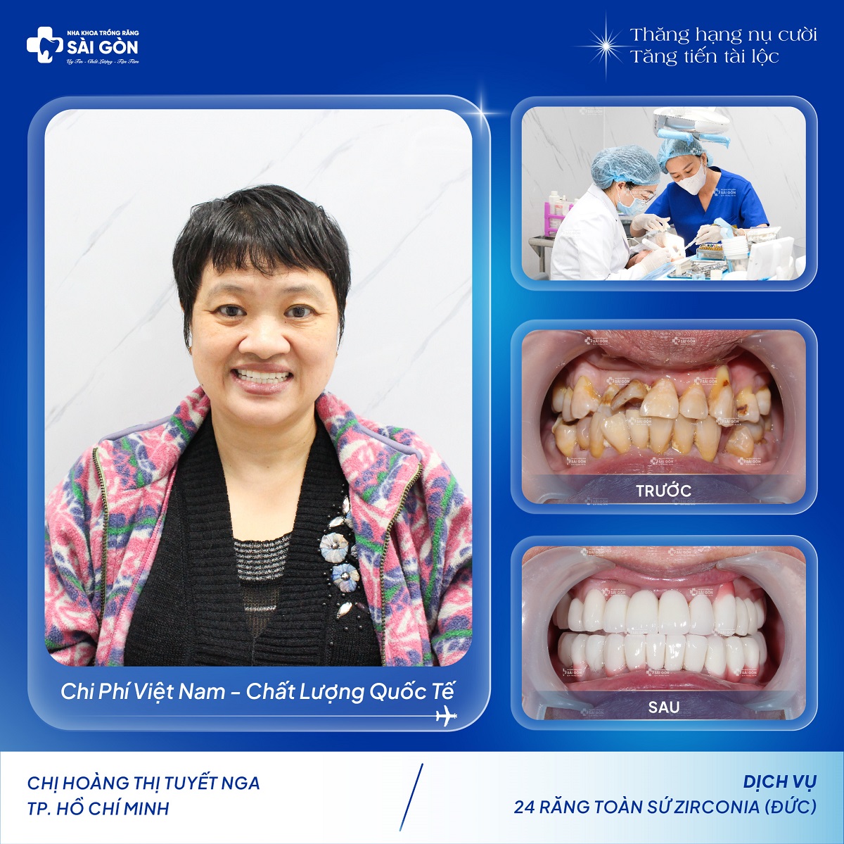 chi hoang thi tuyet nga boc 24 rang su zirconia duc Chị Hoàng Thị Tuyết Nga Bọc 24 Răng Sứ Zirconia của Đức