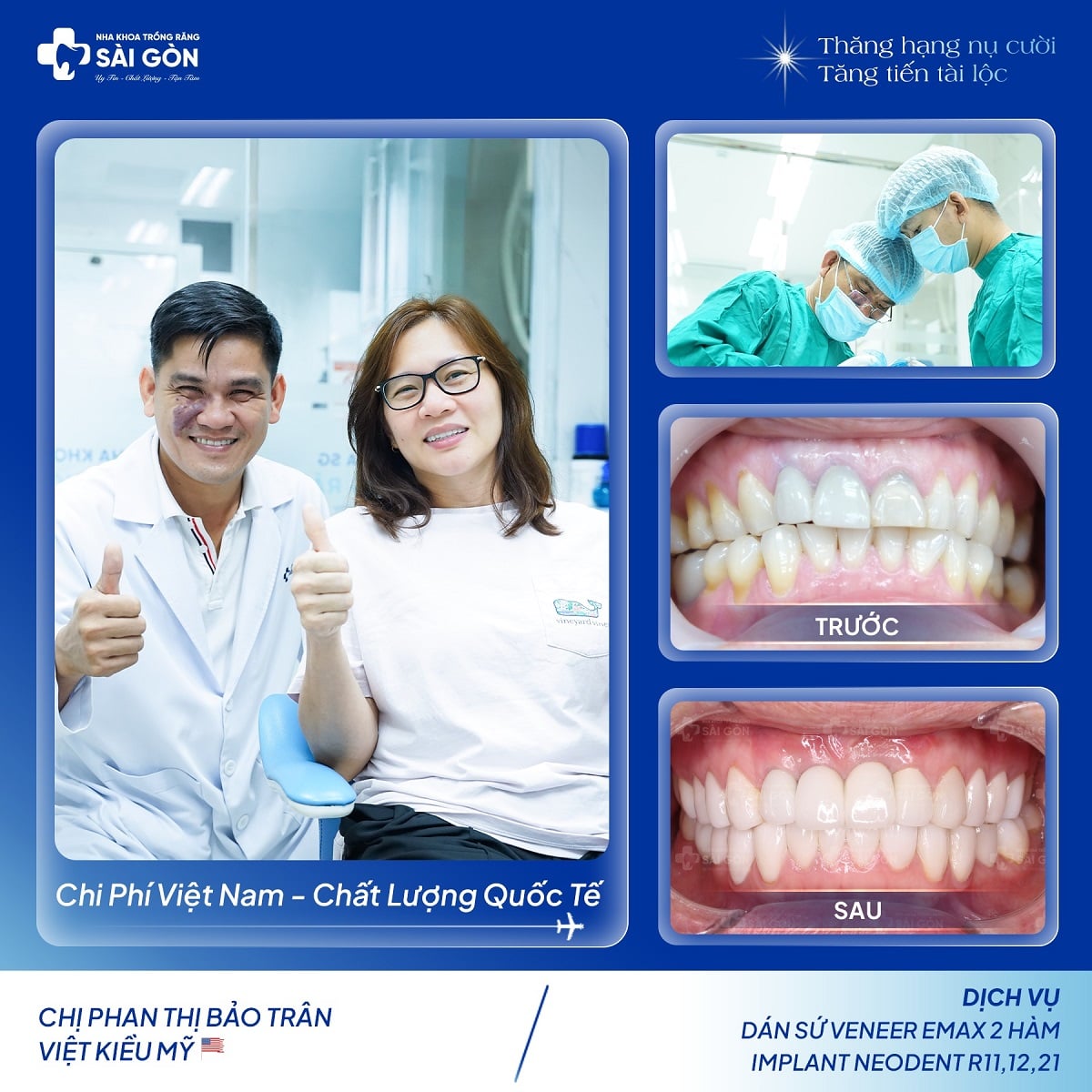 Chị Phan Thị Bảo Trân (Việt Kiều Mỹ) Từ Texas Về Trồng Răng Sứ Và Cấy Ghép Implant Tại Nha Khoa Trồng Răng Sài Gòn