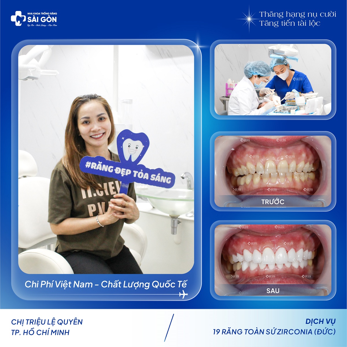 chi trieu le quyen boc 19 rang su zirconia duc Chị Triệu Lệ Quyên Bọc 19 Răng Sứ Zirconia Đức