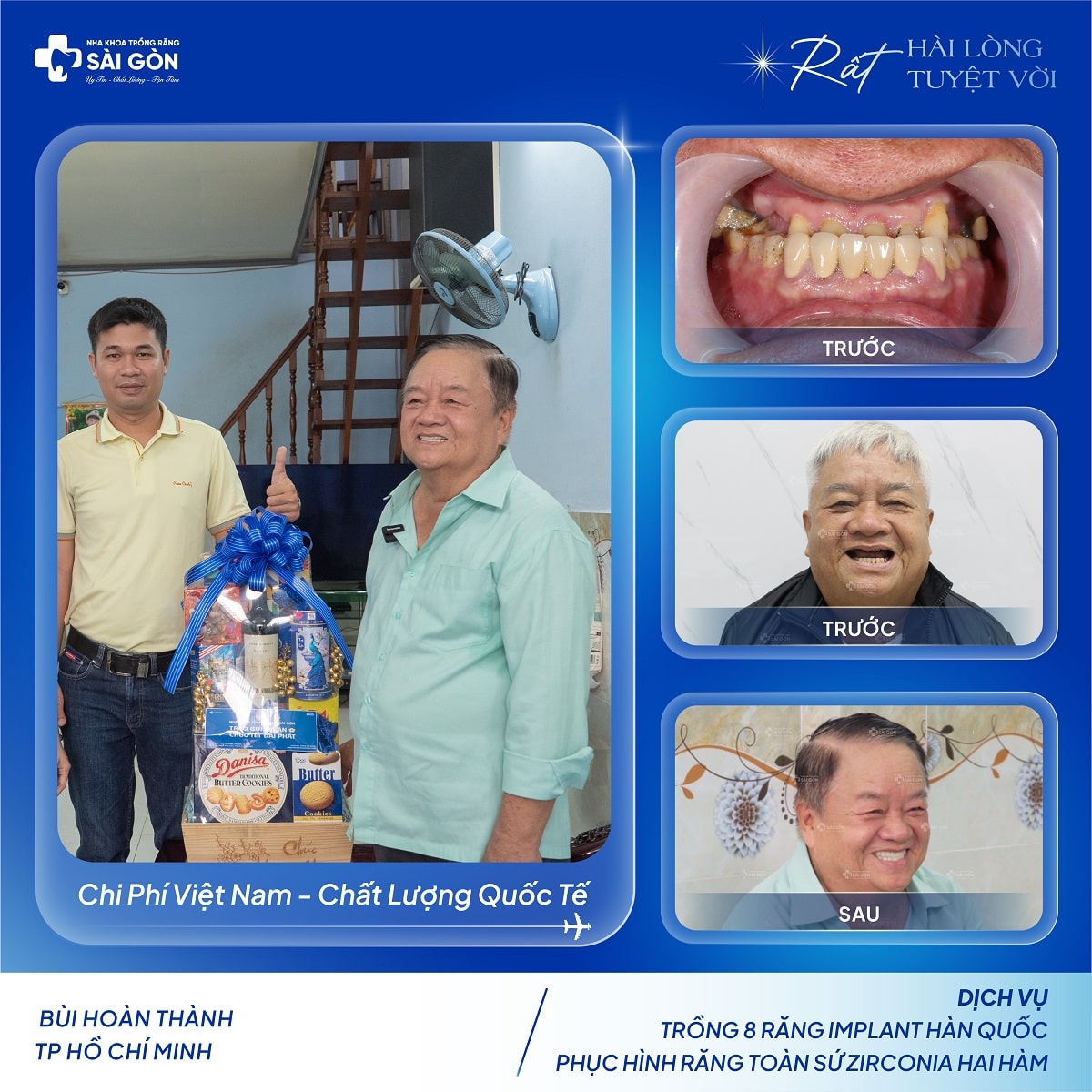 Chú Bùi Hoàn Thành trồng 8 răng implant Hàn Quốc tại Nha Khoa Trồng Răng Sài Gòn