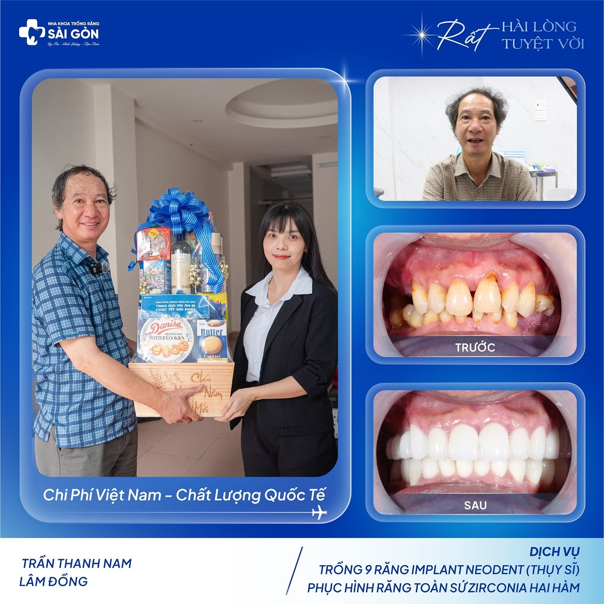 Chú Trần Thanh Nam trồng 9 răng implant Neodent tại Nha Khoa Trồng Răng Sài Gòn
