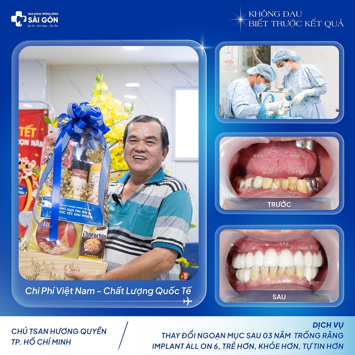 Chú Tsan Hương Quyền (TPHCM) Trồng Răng Implant All On 6 Hai Hàm tại Nha Khoa Trồng Răng Sài Gòn