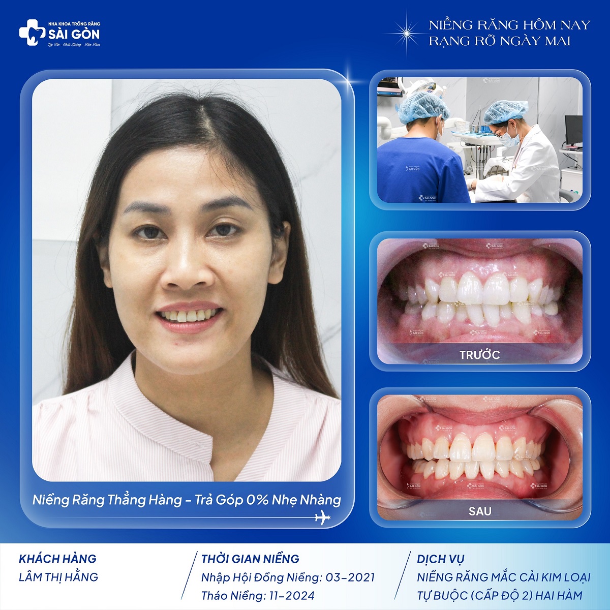 chuc mung khach hang lam thi hang thao nieng 1 Khách hàng tháo niềng Lâm Thị Hằng - Niềng răng mắc cài kim loại tự buộc cấp độ 2 hai hàm