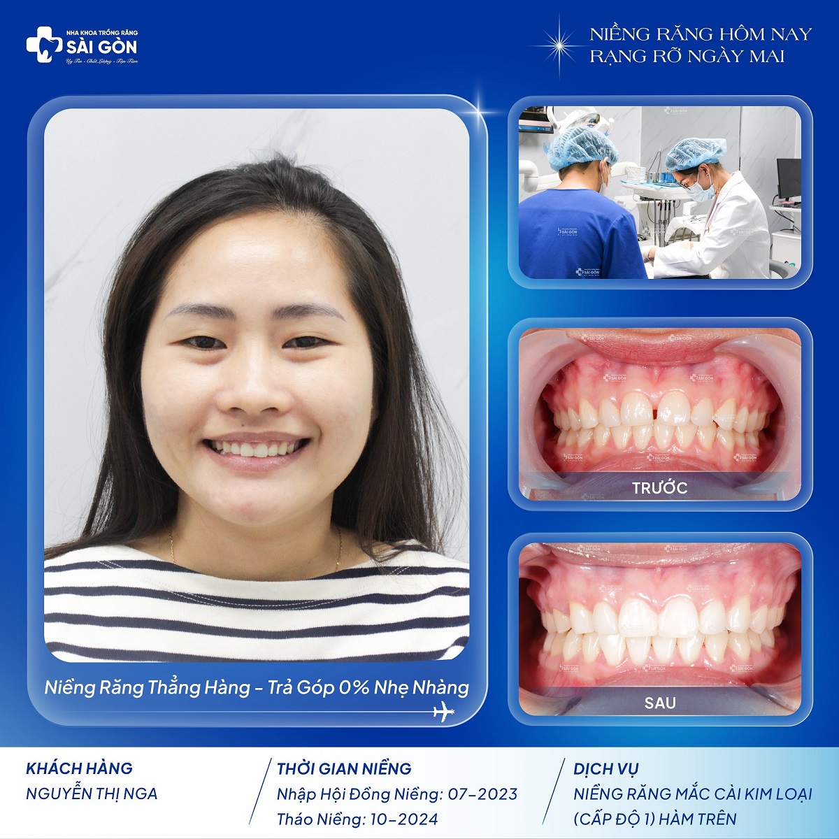 chuc mung khach hang nguyen thi nga thao nieng 1 Khách hàng tháo niềng - Nguyễn Thị Nga tháo niềng hàm trên