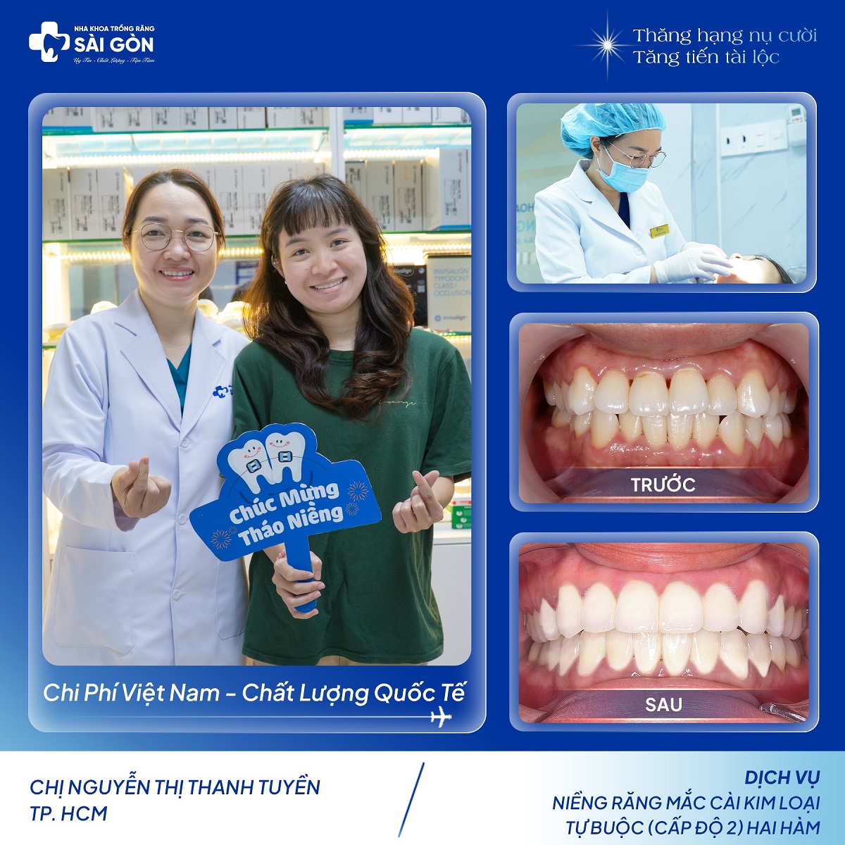 chuc mung thao nieng khach hang nguyen thi thanh tuyen Nguyễn Thị Thanh Tuyền niềng răng mắc cài kim loại tự buộc (cấp độ 2) hai hàm