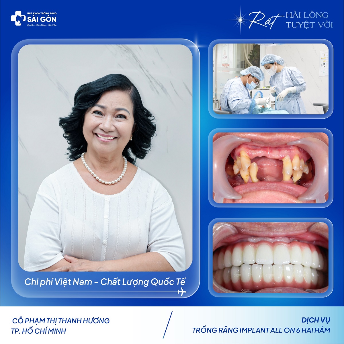 Cô Phạm Thị Thanh Hương Trồng Răng Implant All On Hai Hàm Tại Nha Khoa Trồng Răng Sài Gòn
