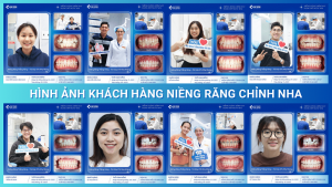 Hình ảnh khách hàng niềng răng chỉnh nha tại Nha Khoa Trồng Răng Sài Gòn