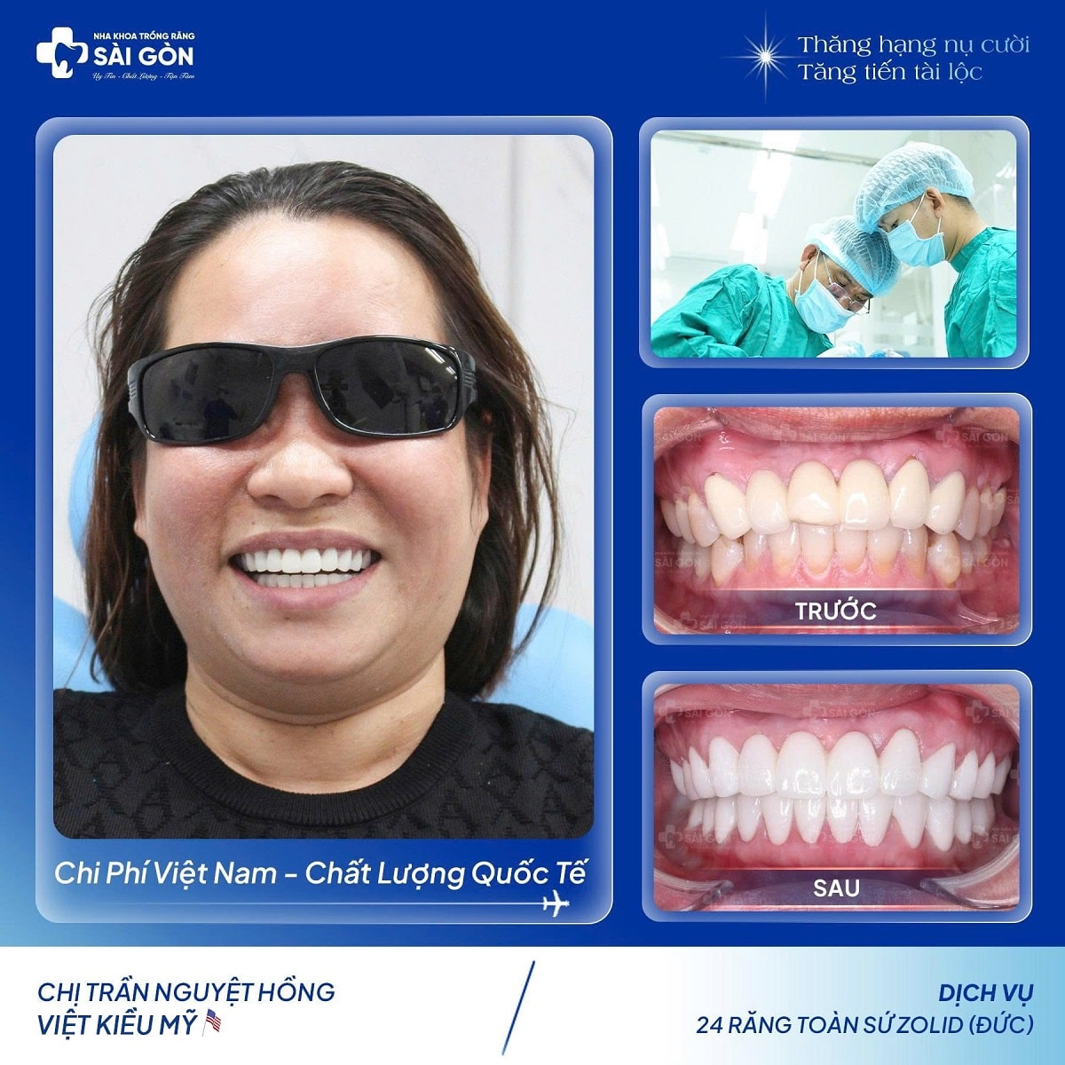 Khách Hàng Bọc Răng Sứ: Chị Trần Nguyệt Hồng Bọc 24 Răng Sứ Lozid (Đức)