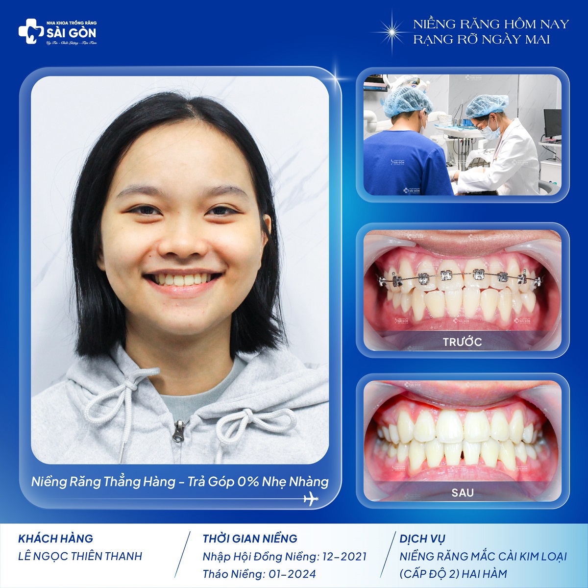 le ngoc thien thanh nieng rang mac cai kim loai Lê Ngọc Thiên Thanh niềng răng mắc cài kim loại cấp độ 2 tại Nha Khoa Trồng Răng Sài Gòn