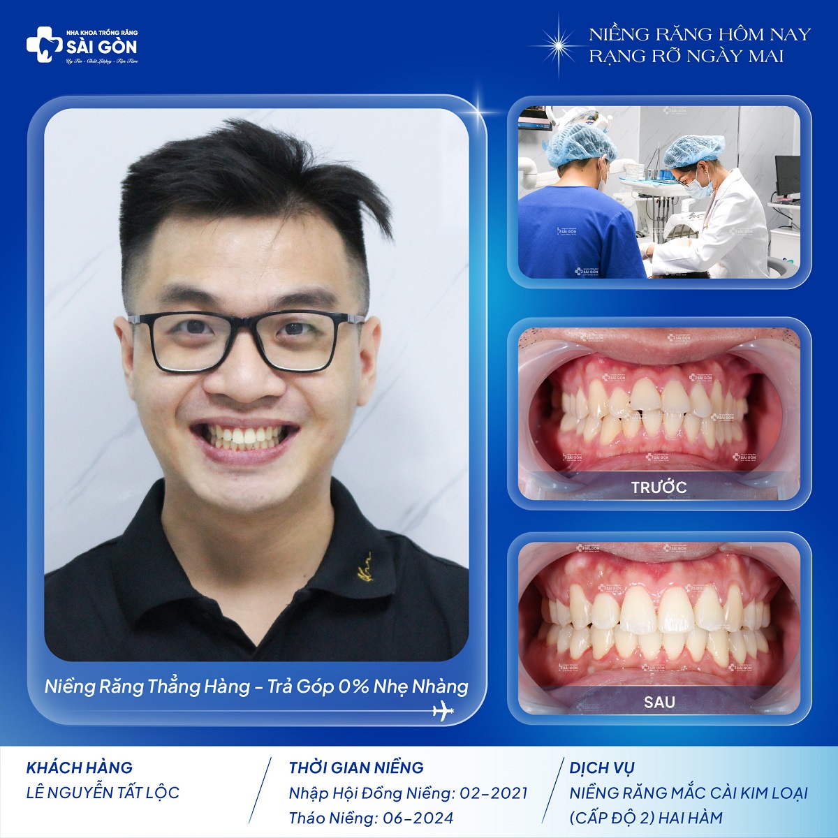 le nguyen tat loc nieng rang mac cai kim loai Lê Nguyễn Tất Lộc niềng răng mắc cài kim loại cấp độ 2