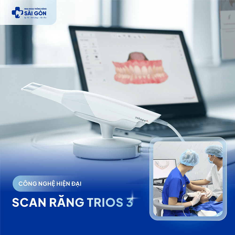 Máy Scan Răng TRIOS 3 - công nghệ hàng đầu thế giới tại Nha Khoa Trồng Răng Sài Gòn