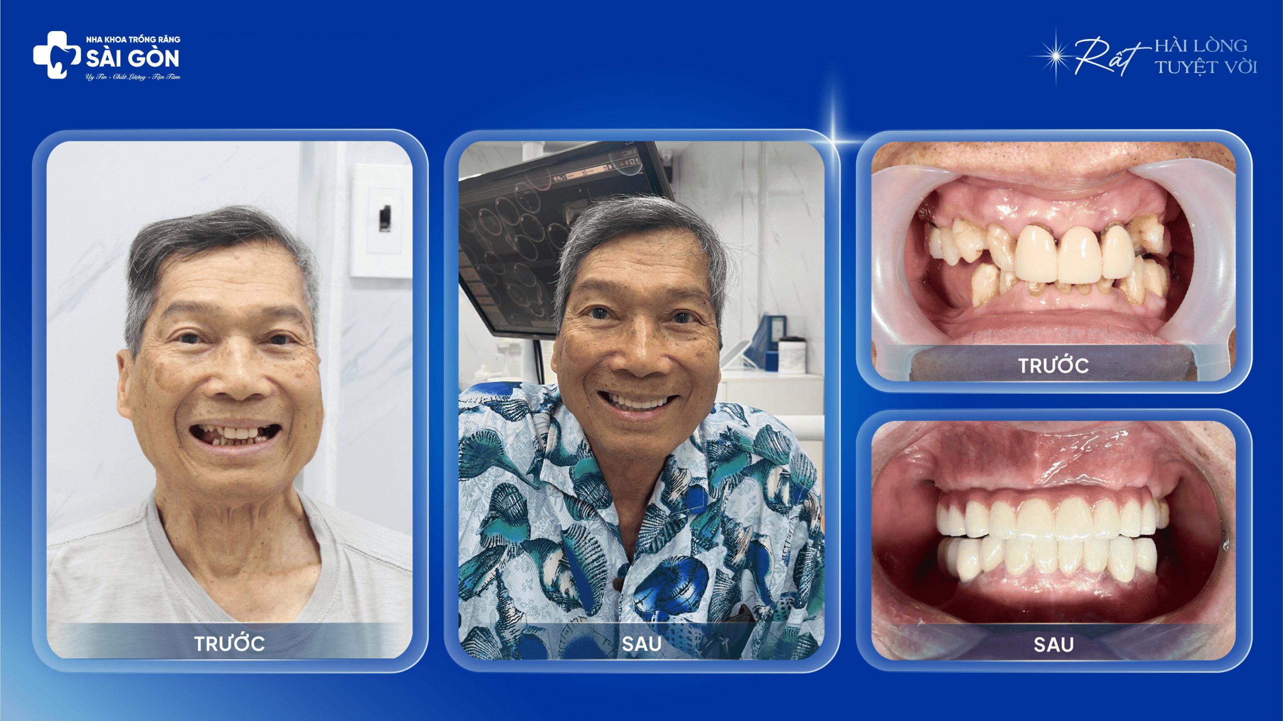 Khách hàng Hoàng Quốc tá Implant