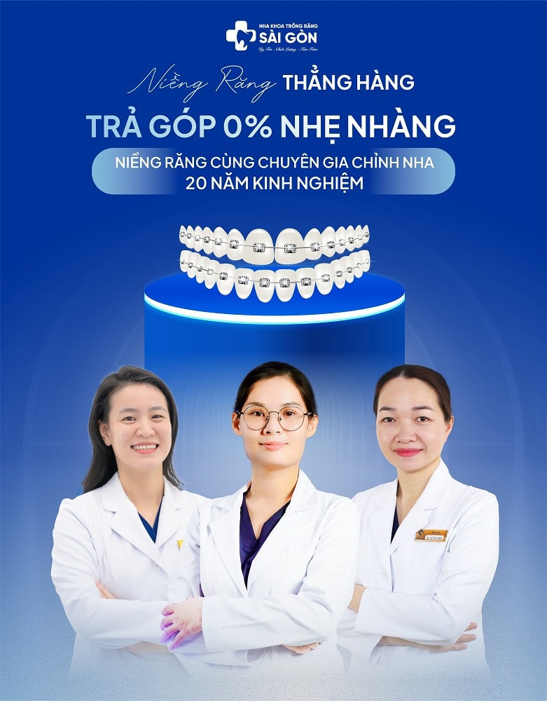 Niềng răng trả góp 0% từ Nha Khoa Sài Gòn