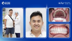 Anh Thân Thế Dũng về nước trồng răng implant