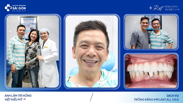 Anh Lâm Trí Hồng Việt Kiều Mỹ Về Nước Trồng Răng Implant All On 6