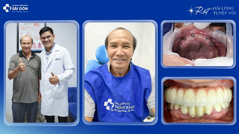 Chú Đào 67 Tuổi Ăn Ngon, Ngủ Ngon Sau Khi Trồng Răng Implant All On 6