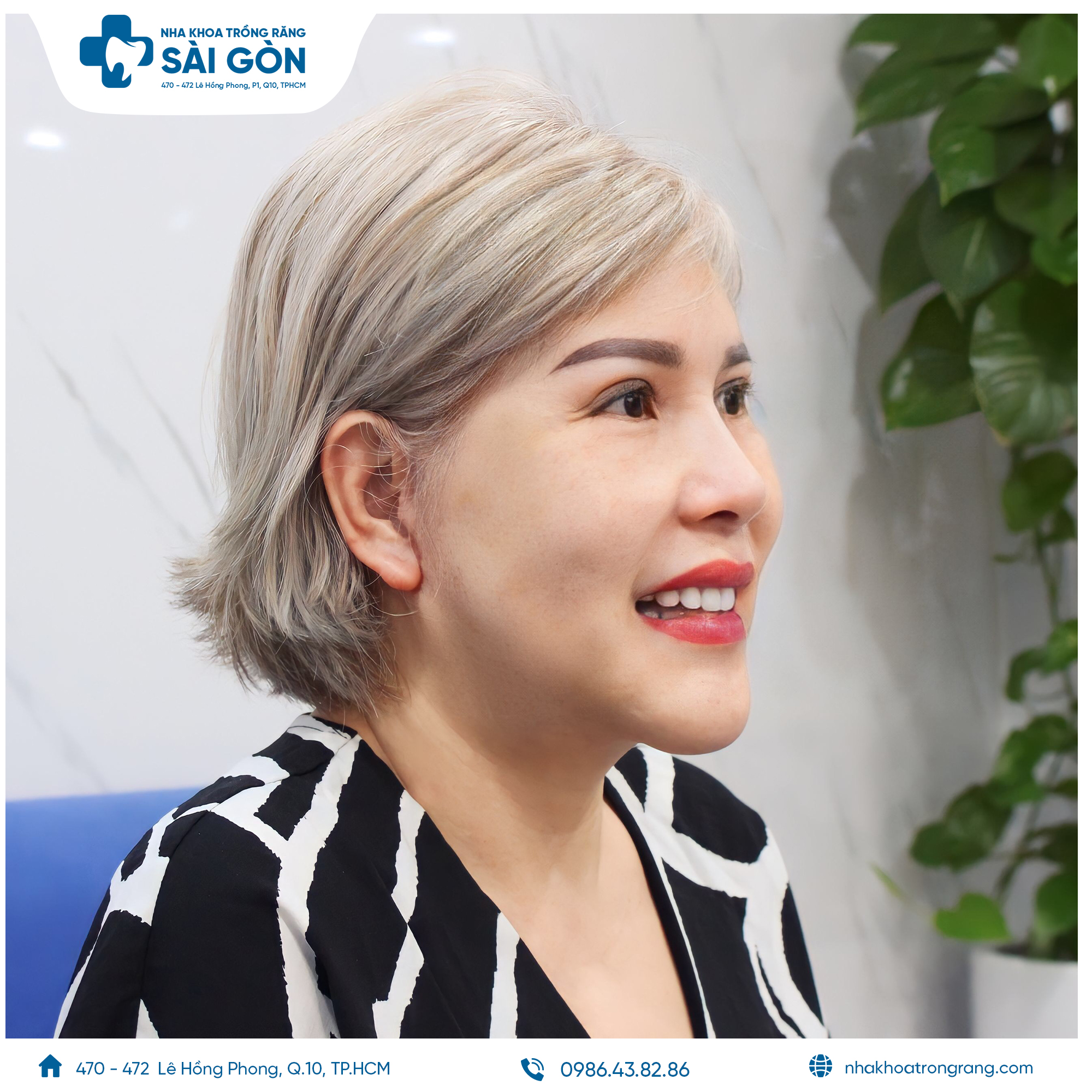 Tina Phương Trần - Việt Kiều Mỹ bọc 20 răng sứ Đức cao cấp