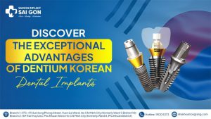 Discover the exceptional advantages of Dentium Korean dental implant