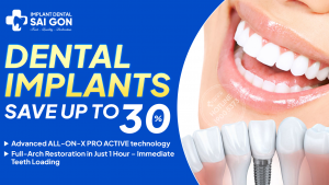 Dental Implants promotion
