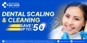 Dental Scaling and Cleaning Save Up to 50%