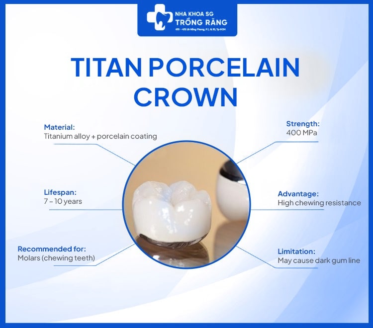 Titan porcelain crown has lifespan 7-10 years