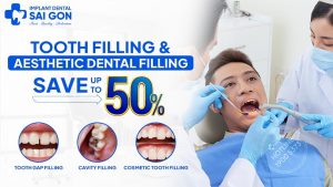 Tooth filling and aesthetic dental filling save up to 50%