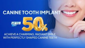 Canine tooth implant up to off 50%