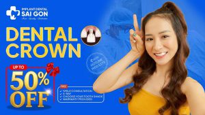 Dental Crown Up To 50% Off