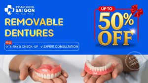 Removable dentures free X-ray and check-up, free expert consultation
