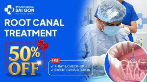 Root canal treatment 50% off