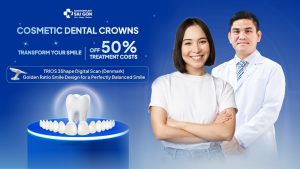 Cosmetic dental crowns transform your smile