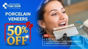 Porcelain veneers 50% off