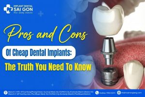 Pros and Cons of cheap dental implants: The truth you need to know