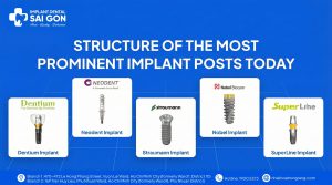Dental Implant Systems: The Most Trusted Implant Brands Used Worldwide Today