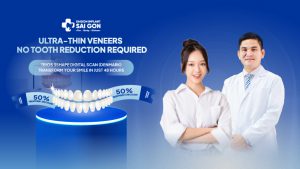 Ultra-thin veneers No tooth reduction required; Trios 3Shape digital scan (Denmark) transform your smile just 48 hours;